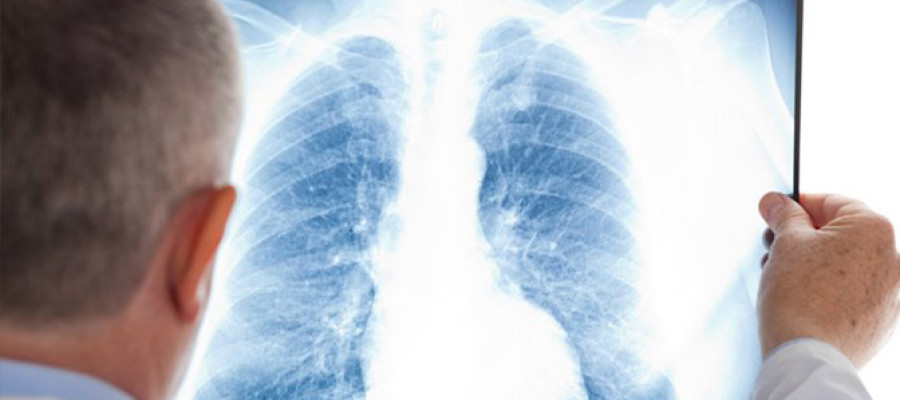 جراحی قفسه سینه