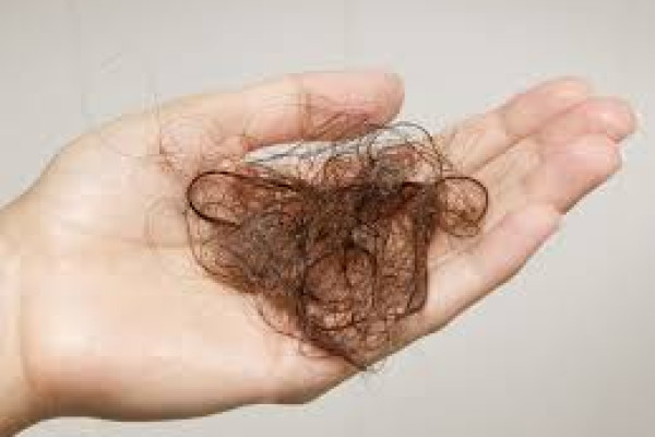 Saç Dökülmesi Neden Olur? Saç Dökülmesi Nasıl Önlenir