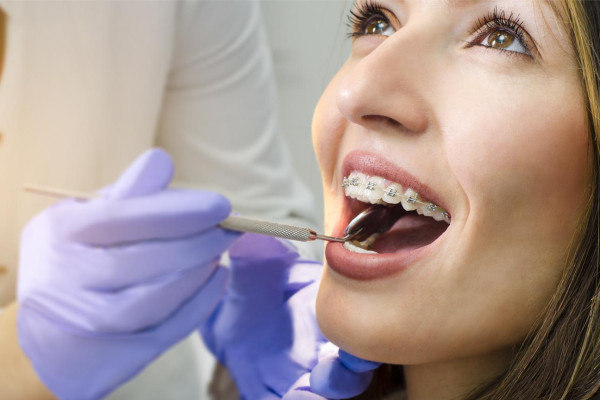 Ortodonti / Diş Teli Tedavileri