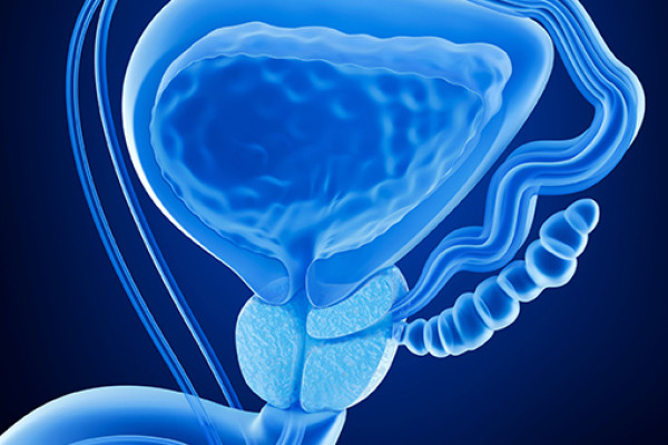 Prostat Kanseri Nedir? Belirtileri ve Tedavi Yöntemleri