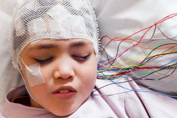 Çocuklarda Epilepsi Belirtileri, Tanı ve Tedavisi